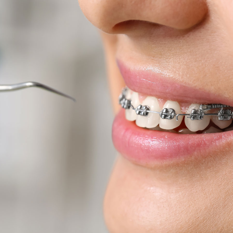 JF Studio Dental | Ortodoncia