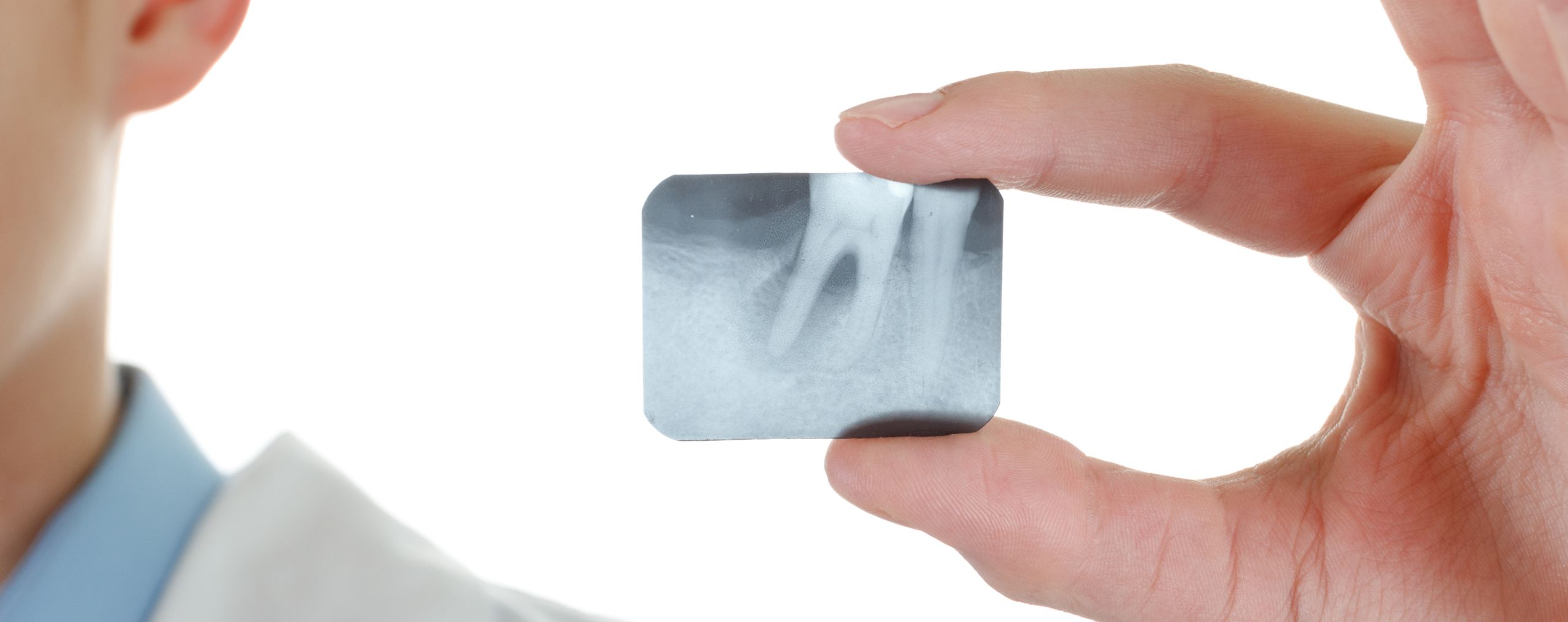 JF Studio Dental | Servicio Periodoncia