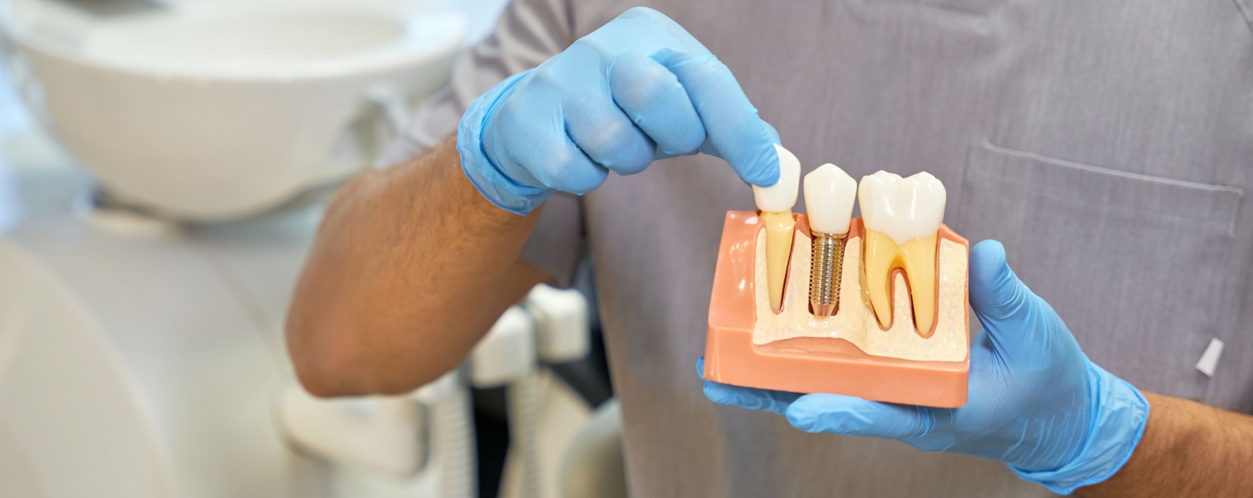 JF Studio Dental | Servicio Implantes dentales