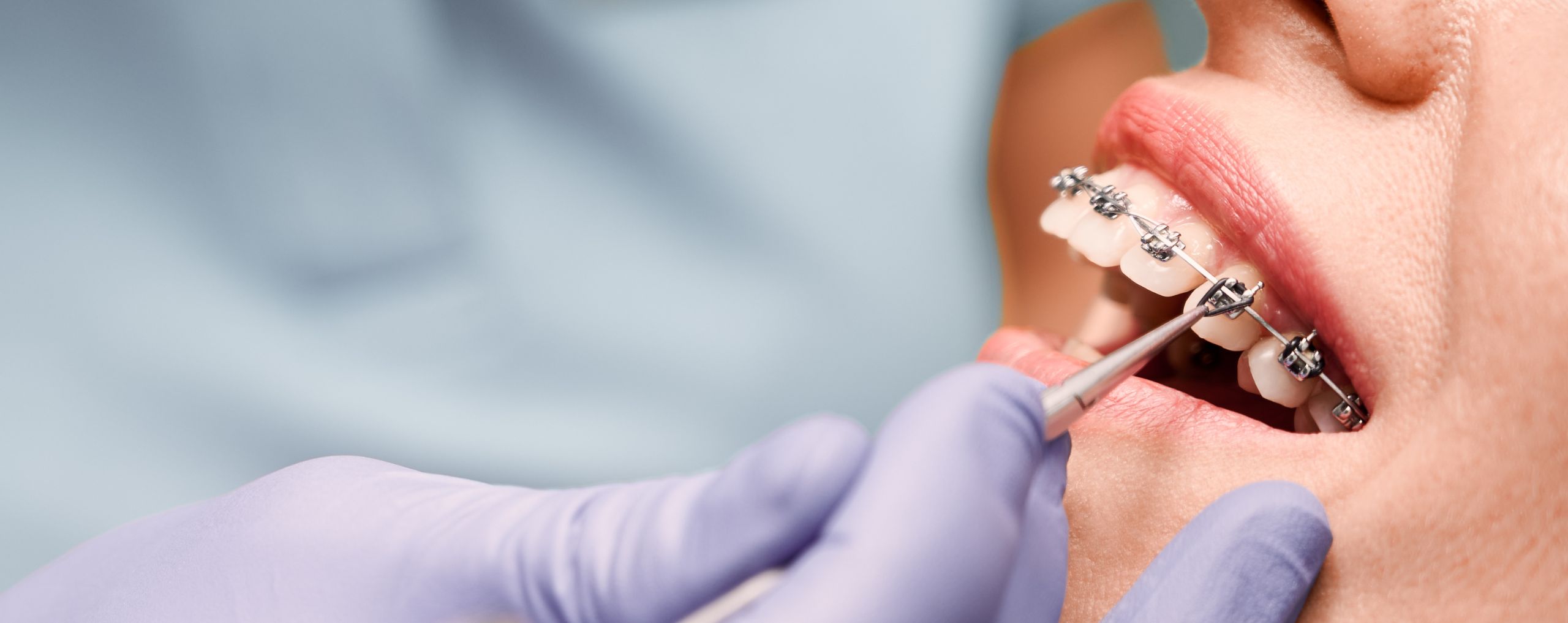 JF Studio Dental | Servicio ortodoncia JF Studio Dental | Servicio ortodoncia