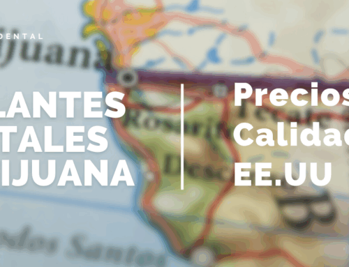 Implantes Dentales en Tijuana | Precios y Calidad de EE.UU.