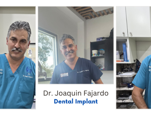 Guía completa sobre implantes dentales: beneficios, problemas comunes y cuidados en Tijuana