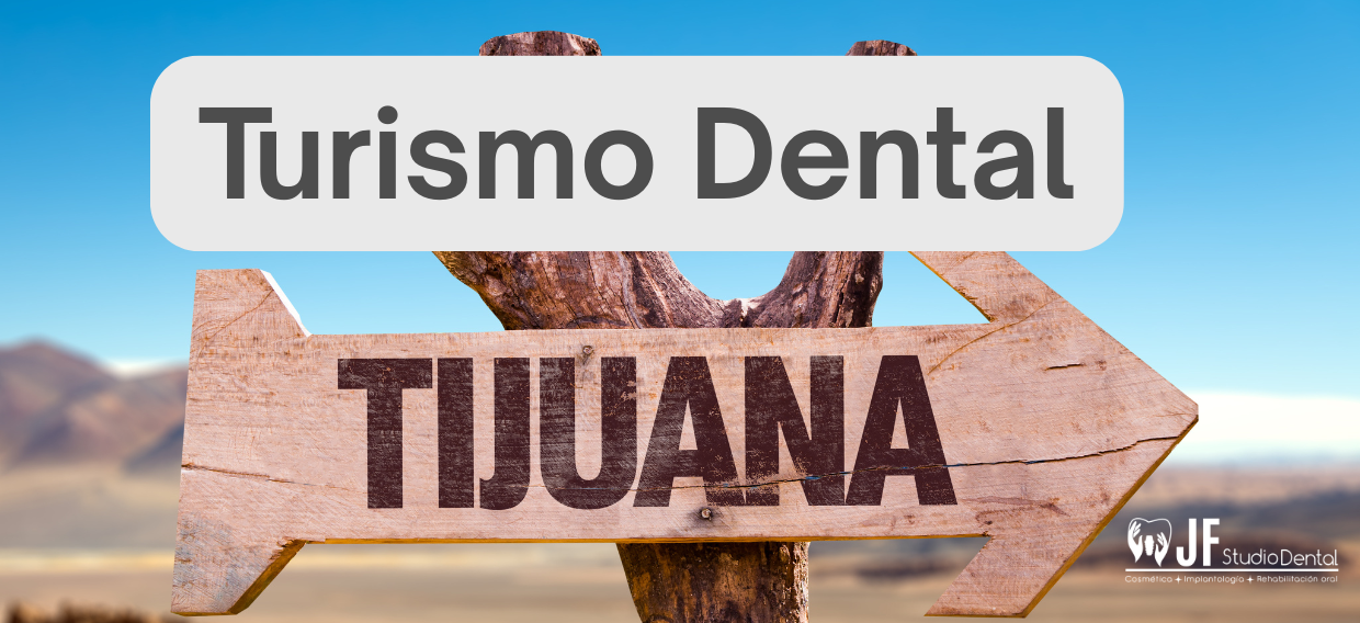 Turismo dental Tijuana Implantes dentales
