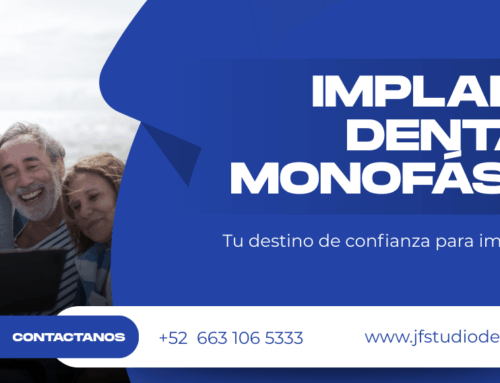 Preguntas Frecuentes sobre los Implantes Dentales Monofásicos en Tijuana